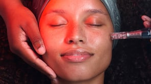 Gros plan sur une personne aux yeux clos recevant un soin du visage. Une main soutient son menton tandis qu'un appareil de microneedling est appliqué sur sa joue. Un côté du visage est éclairé par une lumière rouge vive. Ses cheveux sont bouclés.